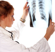 Asbestos Cancer